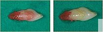 Abb. 1: Mit Erythrosin gefärbte Zähne vor (links) und nach (rechts) LPW mit Glycin (Clinpro 3M Espe) [24].